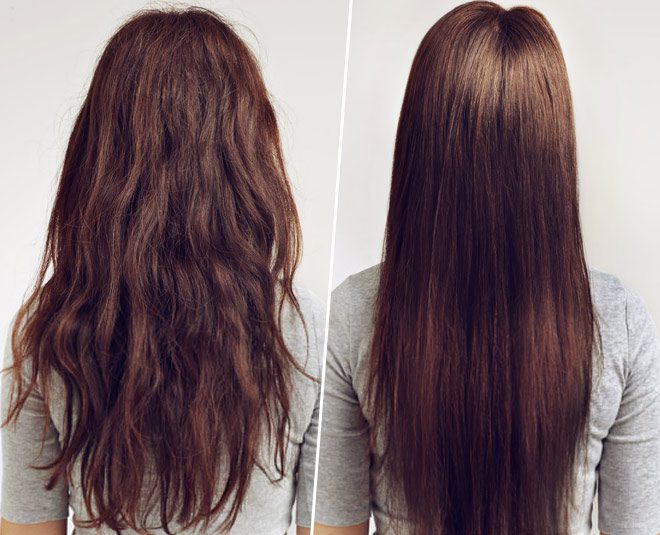 Hair treatment delhi