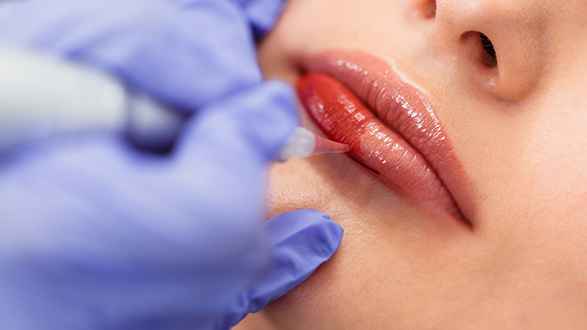 Lip blush