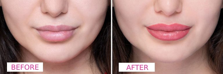 Lip Blush
