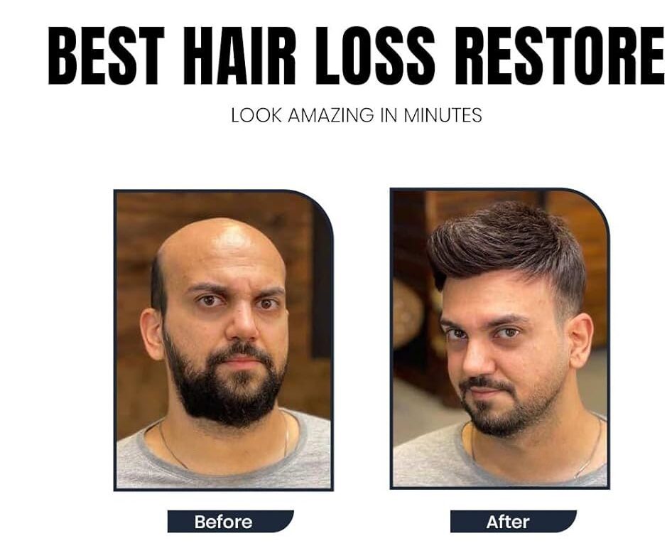 Hair loss has become one of the most common problems among men and women today. Stressful lifestyles, pollution, hormonal imbalance, poor diet, and genetic factors are some of the major reasons behind excessive hair fall. Many people struggle with thinning hair, receding hairlines, and bald patches, which can affect confidence and overall appearance.  If you are searching for the best hair loss treatment in Faridabad, professional clinics now offer advanced, non-surgical solutions that can effectively control hair fall and stimulate natural hair regrowth.  At Aesthetics Mirror Glam Studio, Faridabad, experts provide modern and personalized hair restoration treatments designed to improve scalp health and promote strong, healthy hair growth.  This detailed guide will help you understand the causes of hair loss, available treatments, benefits, and why choosing the right clinic is important.  Understanding Hair Loss  Hair loss is medically known as alopecia, and it occurs when hair follicles weaken or stop producing new hair. Losing around 50–100 strands daily is normal, but excessive hair shedding can indicate an underlying problem.  Hair loss can affect both men and women and may appear in different forms such as:  Gradual thinning on the scalp  Receding hairline  Bald patches  Sudden hair shedding  Weak and brittle hair  Early diagnosis and proper treatment can help prevent permanent hair loss.  Common Causes of Hair Loss 1. Genetic Hair Loss  Genetic hair loss, also known as androgenetic alopecia, is one of the most common causes. It usually results in:  Male pattern baldness  Female pattern thinning  This condition gradually weakens hair follicles over time.  2. Hormonal Imbalance  Hormonal changes caused by:  Pregnancy  Thyroid disorders  PCOS  Menopause  can lead to severe hair fall.  3. Stress and Lifestyle  Modern lifestyle habits play a major role in hair damage. Factors include:  Lack of sleep  Work stress  Poor diet  Smoking and alcohol  These factors weaken the hair growth cycle.  4. Nutritional Deficiency  Hair requires essential nutrients such as:  Iron  Biotin  Protein  Zinc  Vitamin D  Deficiency of these nutrients can result in excessive hair fall.  5. Scalp Infections  Dandruff, fungal infections, and scalp inflammation can damage hair follicles and cause hair thinning.  Signs You Need Hair Loss Treatment  Many people ignore early symptoms of hair loss until the problem becomes severe. Some warning signs include:  Hair fall during combing or washing  Widening hair parting  Visible scalp  Receding hairline  Thinning ponytail  Bald patches  If you notice these symptoms, consulting a specialist is recommended.  Advanced Hair Loss Treatments in Faridabad 4  Modern hair restoration treatments focus on stimulating hair follicles and improving scalp health without surgery.  At Aesthetics Mirror Glam Studio Faridabad, several advanced techniques are used for effective results.  1. PRP Hair Treatment  PRP (Platelet-Rich Plasma) therapy is one of the most popular non-surgical hair loss treatments.  How PRP Works  A small amount of blood is drawn from the patient.  The blood is processed in a centrifuge to extract platelet-rich plasma.  The PRP is injected into the scalp.  Benefits  Stimulates natural hair growth  Strengthens weak hair follicles  Reduces hair fall  Improves hair density  PRP treatment is safe and widely recommended by hair specialists.  2. Hair Growth Therapy  Hair growth therapy combines scalp treatments, medical solutions, and advanced equipment to boost hair growth.  Benefits  Improves blood circulation in the scalp  Nourishes hair roots  Strengthens hair follicles  Promotes thicker hair  This therapy works well for people experiencing early-stage hair thinning.  3. Scalp Treatment  A healthy scalp is essential for strong hair growth. Professional scalp treatments remove buildup, excess oil, and dandruff.  Key Benefits  Deep scalp cleansing  Reduced dandruff  Improved hair growth  Balanced scalp health  4. Hair Patch or Non-Surgical Hair Replacement 4  For people with severe baldness, hair patch treatment offers an instant solution.  A hair patch is a customized hair system attached to the scalp using medical-grade adhesives or clips.  Advantages  Immediate hair transformation  Natural appearance  Non-surgical solution  Affordable alternative to hair transplant  Hair patches are especially popular among men experiencing advanced baldness.  Benefits of Professional Hair Loss Treatment  Choosing professional treatment provides several advantages.  1. Accurate Diagnosis  Hair specialists analyze scalp condition and determine the exact cause of hair loss.  2. Customized Treatment Plan  Each patient receives a personalized solution based on their hair type and condition.  3. Safe and Effective Techniques  Modern clinics use advanced technology and dermatologist-approved procedures.  4. Long-Term Results  Professional treatments strengthen hair roots and improve long-term hair growth.  Why Choose Aesthetics Mirror Glam Studio in Faridabad 4  If you are looking for the best hair loss treatment in Faridabad, Aesthetics Mirror Glam Studio provides advanced solutions for hair restoration.  Key Highlights  ✔ Experienced hair specialists ✔ Advanced PRP hair therapy ✔ Non-surgical hair replacement ✔ Personalized scalp treatments ✔ Hygienic and modern clinic environment  The clinic focuses on providing safe and effective hair restoration treatments for both men and women.  Hair Care Tips to Prevent Hair Loss  In addition to professional treatments, following a healthy hair care routine can prevent hair fall.  Maintain a Healthy Diet  Include foods rich in:  Protein  Iron  Biotin  Omega-3 fatty acids  Reduce Heat Styling  Frequent use of straighteners and curling tools can weaken hair roots.  Use Mild Hair Products  Avoid harsh chemicals and choose sulfate-free shampoos.  Manage Stress  Yoga, meditation, and exercise help control stress-related hair fall.  Regular Scalp Massage  Scalp massage improves blood circulation and promotes hair growth.  Who Should Consider Hair Loss Treatment  Hair restoration treatments are suitable for:  Men with receding hairlines  Women with thinning hair  Individuals experiencing excessive hair fall  People with bald patches  Patients with weak hair growth  Early treatment ensures better and faster results.  How Long Does Hair Loss Treatment Take  Treatment duration varies depending on the condition.  Typical timeline:  PRP Therapy: 3–6 sessions  Hair Growth Treatment: 2–4 months  Scalp Therapy: Monthly sessions  Hair Patch: Instant results  Hair regrowth usually becomes noticeable within 3–4 months.  Cost of Hair Loss Treatment in Faridabad  The cost depends on factors such as:  Type of treatment  Number of sessions  Hair loss severity  Technology used  Non-surgical treatments like PRP and scalp therapy are generally more affordable than hair transplant procedures.  For accurate pricing, consultation with a specialist is recommended.  Final Thoughts  Hair loss can be distressing, but modern aesthetic treatments have made it possible to restore hair effectively without surgery. From PRP therapy and scalp treatments to non-surgical hair replacement systems, advanced techniques now provide safe and reliable solutions.  If you are experiencing hair fall, early treatment can prevent further damage and promote healthy hair growth.  For the best hair loss treatment in Faridabad, visit Aesthetics Mirror Glam Studio, where experts provide personalized hair restoration solutions using the latest technology.  Regain your confidence and achieve stronger, healthier hair with professional hair care treatments designed for long-lasting results.