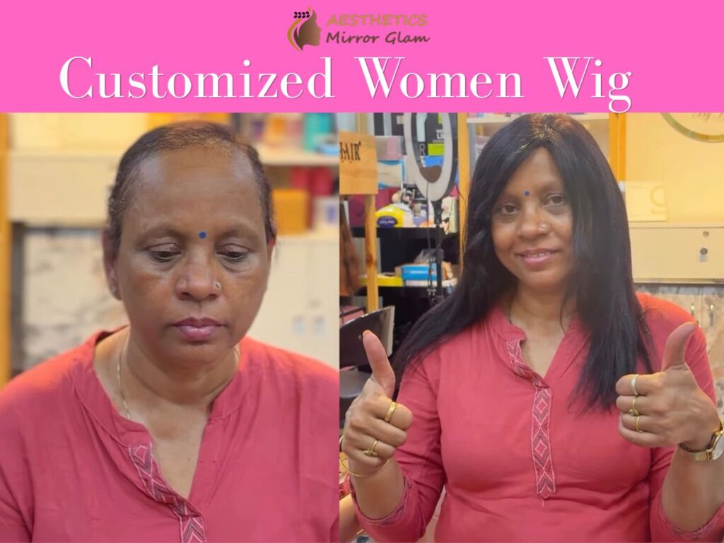 Customized Women Wig in rohini, delhi
