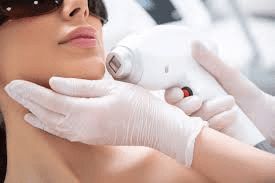 facial hair removal