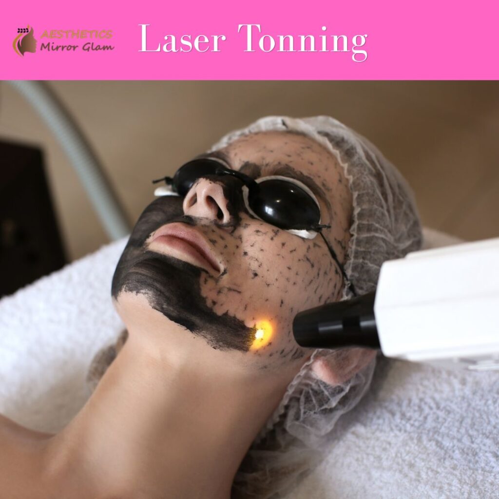 Carbon peel Laser tonning near me, carbon facial in rohini delhi
