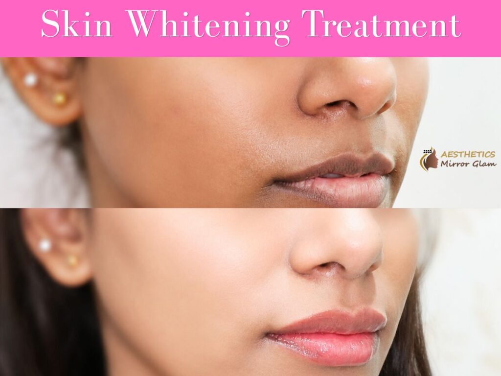 Skin whitening treatment delhi